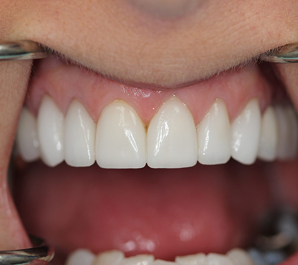 Closeup of Mardi's teeth