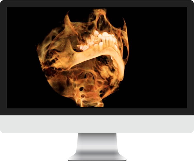 Stylized image of a skull X-ray