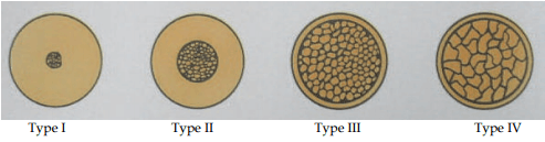 Types of bone densities