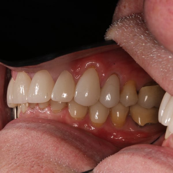 Closeup of teeth